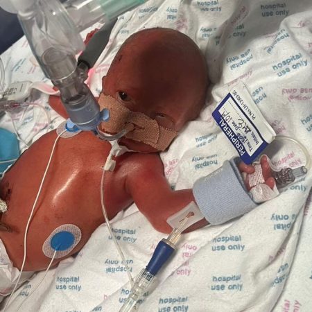 Baby Cooper Miracle Baby Cooper